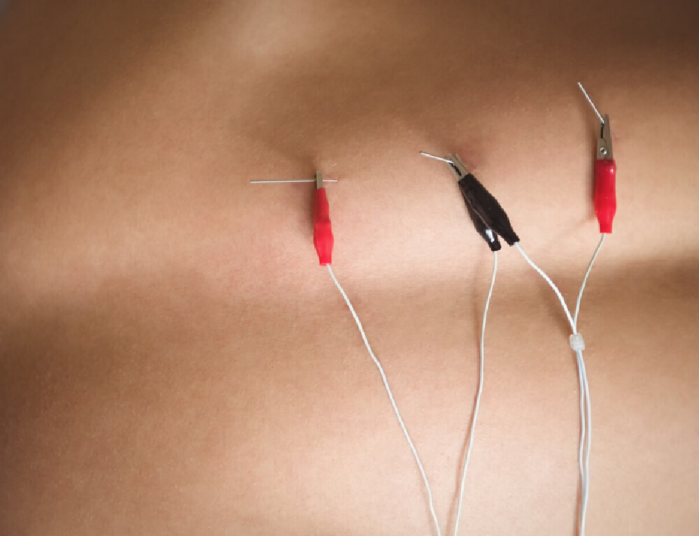 Peripheral at Pain & Headache Center